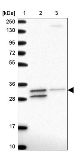 Tollip Antibody, Novus Biologicals:Antibodies:Primary Antibodies